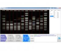 LadderVision® Electrophoresis Image Analysis Software
