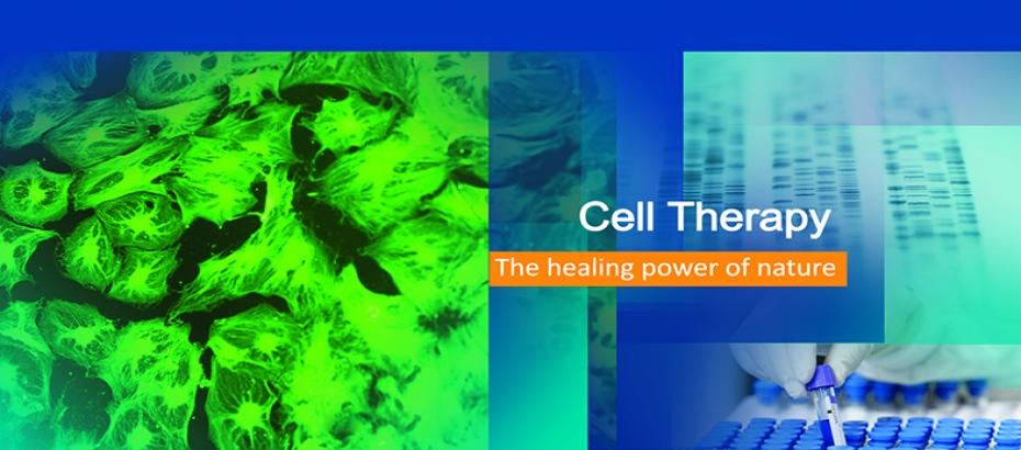 Wharton Jelly Mesenchymal Stem Cells